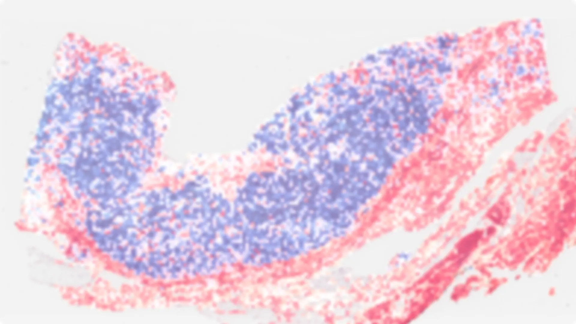 Scan of the digital pathology algorithm